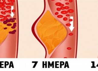Τι είναι η δίαιτα ΝΤΑΣ; Γιατί οι γιατροί την θεωρούν μια από τις καλύτερες για την υγεία