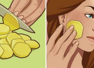 Έκοψε μια φέτα πατάτας και την εβαλε στο πρόσωπό της – Μια εβδομάδα μετά…