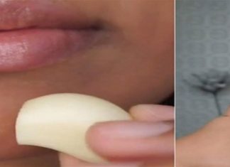 Σκόρδο: Το μυστικό για να φύγει το σπυράκι – Δείτε πως