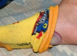 Έβαλε ένα κρεμμύδι στην κάλτσα της και κοιμήθηκε – Ο λόγος θα σας αφήσει άφωνους!