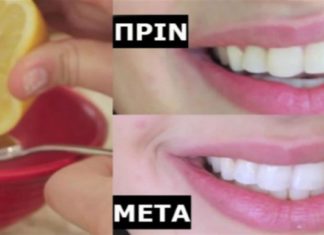 Λεμόνι: 2 τρόποι για να αντιμετωπίσετε τα προβλήματα με τα δόντια σας