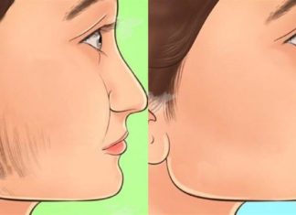 Τριχοφυΐα στο πρόσωπο: 9 σπιτικές συνταγές για να εξαφανίσεις τις ανεπιθύμητες τρίχες χωρίς να πονέσεις