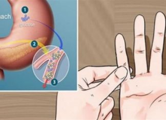 Μήπως έχετε διαβήτη; Δείτε τα χέρια σας…