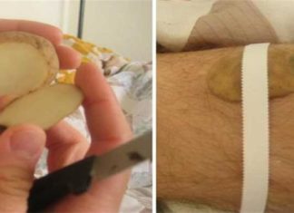 Πήρε μια πατάτα, την έκοψε και τύλιξε με ταινία ένα μικρό κομμάτι της στο πόδι του – Θα τρελαθείτε μόλις μάθετε το λόγο
