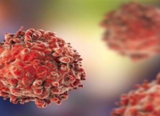 Κίνδυνος – θάνατος: Η τροφή που πρέπει να κόψετε μαχαίρι αν θέλετε να «πολεμήσετε» τον καρκίνο