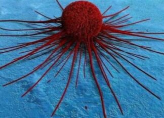 Τα καρκινικά κύτταρα τρέφονται με 10 τροφές που υπερκαταναλώνουμε οι περισσότεροι