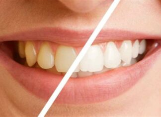 Δόντια στην…πένα: Αυτό είναι το φρούτο που τα κάνει λευκά στο λεπτό και το έχουμε όλοι στην κουζίνα