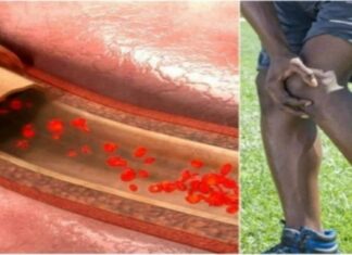 8+1 συμπτώματα που υποδηλώνουν ότι έχετε θρόμβο στο αίμα σας – Ιδιαίτερη προσοχή στο 3ο