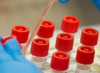 Κορωνοϊός: Δεν φαντάζεστε ποιο βασικό συστατικό της διατροφής μας εξασθενεί το ανοσοποιητικό