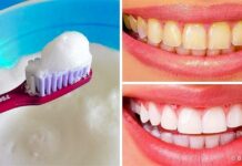 Οι 10 καλύτεροι τρόποι να λευκάνετε τα δόντια σας με φυσικό τρόπο στο σπίτι